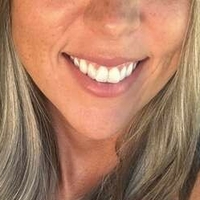 бейзболмам Голи