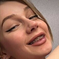 лизипърпъл Голи