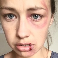 Лорна Демпси Голи
