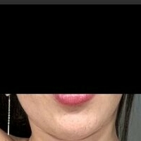 Мелина Итхуррат Голи