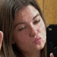 Мишеллерени Голи