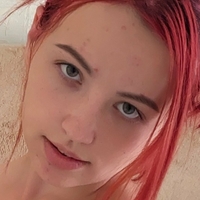 Мисалесия Голи