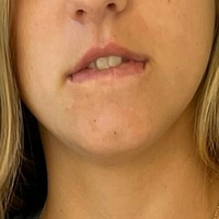 наутиема Голи