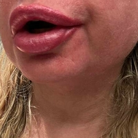 Нина НортСтар Голи