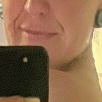 Нотсопоси Голи