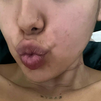 notyourbabyt Голи