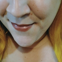 roguemelons Голи